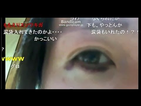 【ハルヒ】高須で10万円かけて涙袋を入れる【関慎吾　ニコ生】 - YouTube