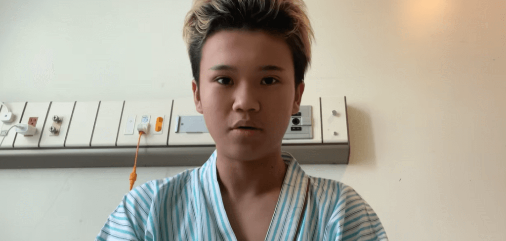 目を二重に整形