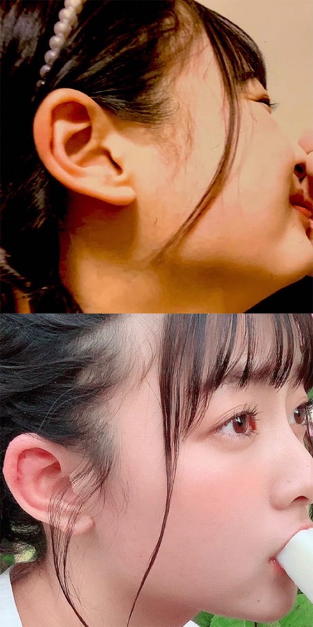 キス写真（上）と今泉美利愛さんの画像の耳を比較