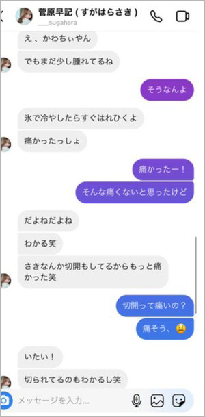 門脇実優菜さんの整形疑惑が浮上したDM