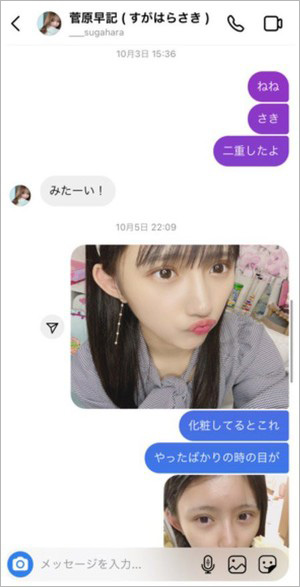 門脇実優菜さんの整形疑惑が浮上したDM