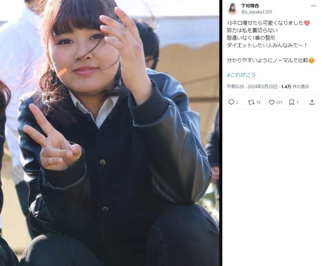 下村明香は整形なの？